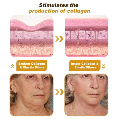 Bee Venom Botox Wrinkle Repair Cream